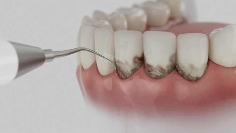Trusted Tooth Extraction service in New Hope, MS - Dentist Open Now